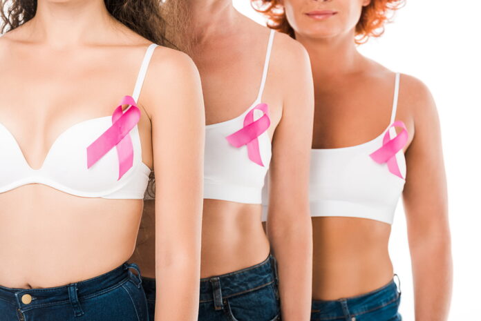 Cáncer de mama: síntomas, prevención, diagnóstico y tratamiento. Aprende a cuidar tu salud y reducir riesgos con hábitos saludables.